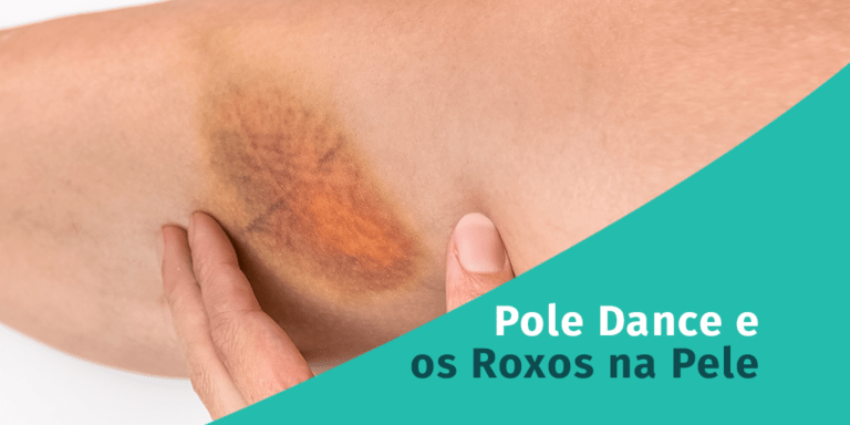 Pole Dance e os Roxos na Pele